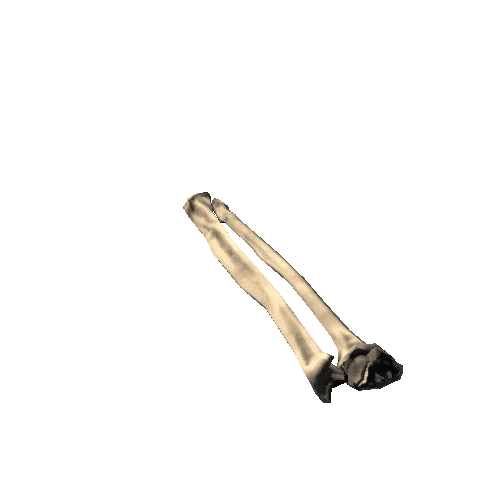 Ulna_Radius_left