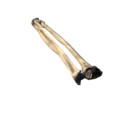 Ulna_Radius_left