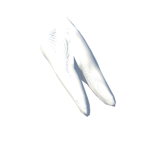 Tooth_Caries_bottom_5_L