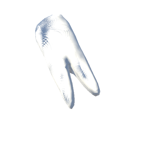 Tooth_Caries_bottom_5_R