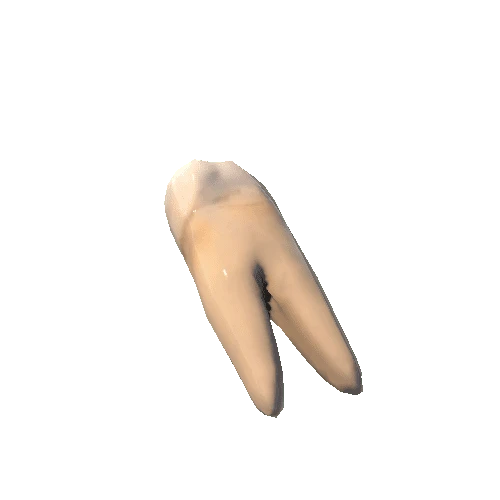 Tooth_Mouth_top_5_R